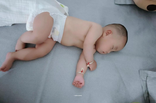 大竹六个月宝宝眼睛散光